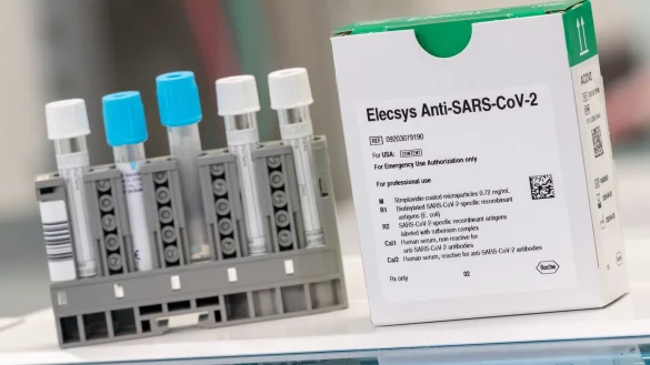 Antik&ouml;rpertest Elecsys - &copy; Foto: Peter Kneffel/dpa