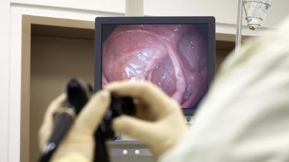 Eine Darmspiegelung kann Leben retten und die Entstehung von Darmkrebs verhindern. - © imago/Rupert Oberhäuser