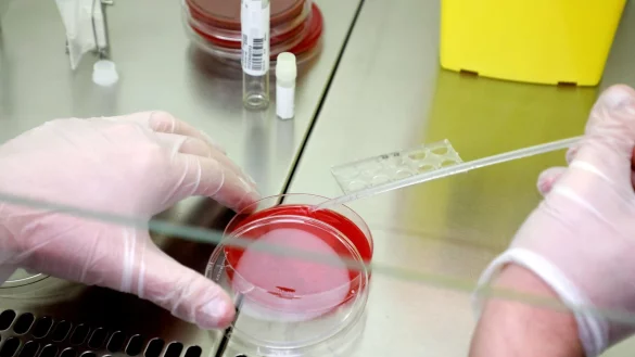 Pathologen fordern mehr Obduktionen von nach einer Corona-Infektion gestorbenen Menschen. - © dpa