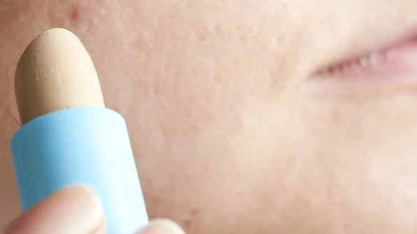 Pickel abdecken - © Foto: Andrea Warnecke