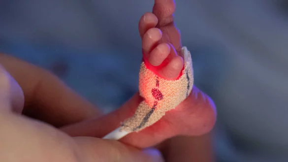 Frühgeborene, die weniger als 1.250 Gramm wiegen, dürfen künftig nur noch in drei Krankenhäusern in OWL versorgt werden. - © picture alliance/dpa