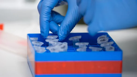 Untersuchungen - &copy; Foto: Christophe Gateau/dpa