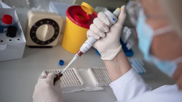 Corona-Antik&ouml;rper - &copy; Foto: Marijan Murat/dpa