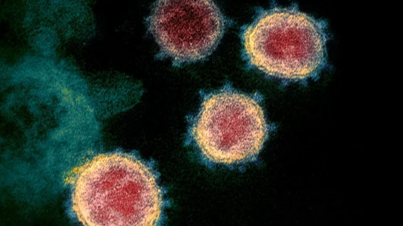 Coronavirus - &copy; Foto: Uncredited/NIAID-RML/AP/dpa