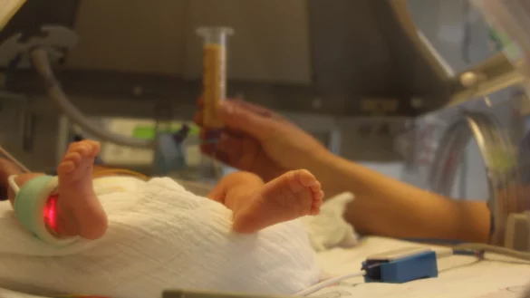 Ein Frühchen wird über eine Sonde mit Muttermilch versorgt. - © Archivfoto: Janet König