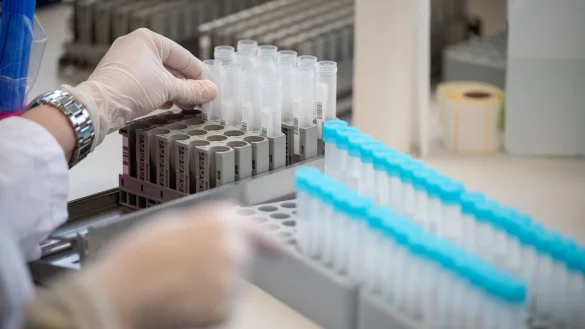 PCR-Test - &copy; Foto: Sebastian Gollnow/dpa