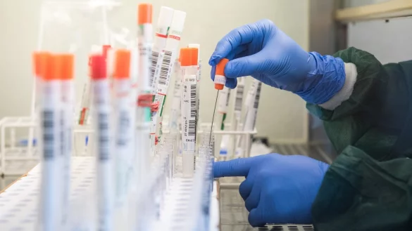 Testauswertung im Labor - &copy; Foto: Daniel Bockwoldt/dpa