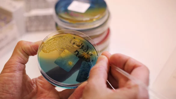 Gewebeproben - &copy; Foto: &Oslash;rn E. Borgen/NTB scanpix