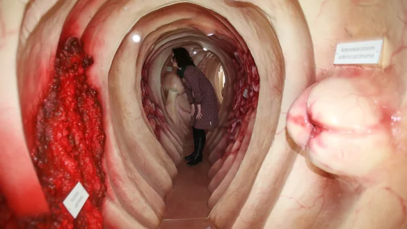 Begehbares Darm-Modell - &copy; Foto: Bodo Schackow