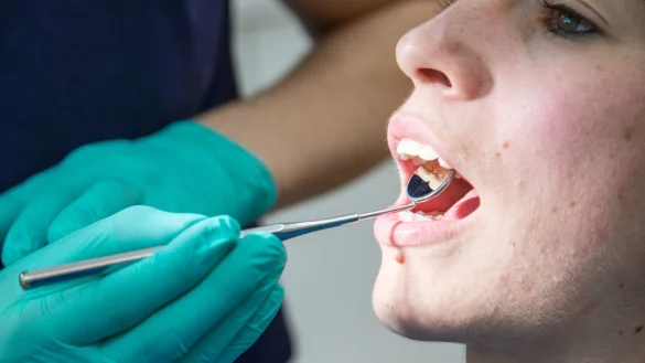 Was bringen Tests bei Parodontitis? - &copy; Foto: Christin Klose/dpa-tmn