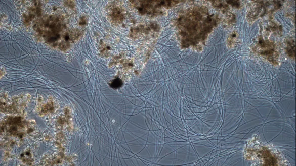 Bläschlamm unter dem Mikroskop - © Privat