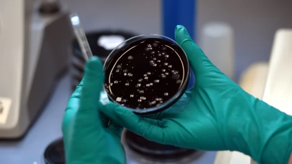 Legionellen - &copy; Foto: picture alliance / dpa